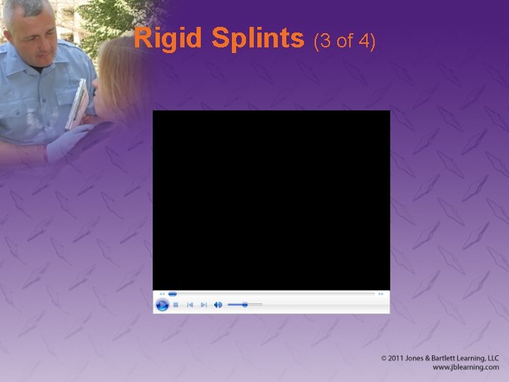 Rigid Splints (3 of 4) 