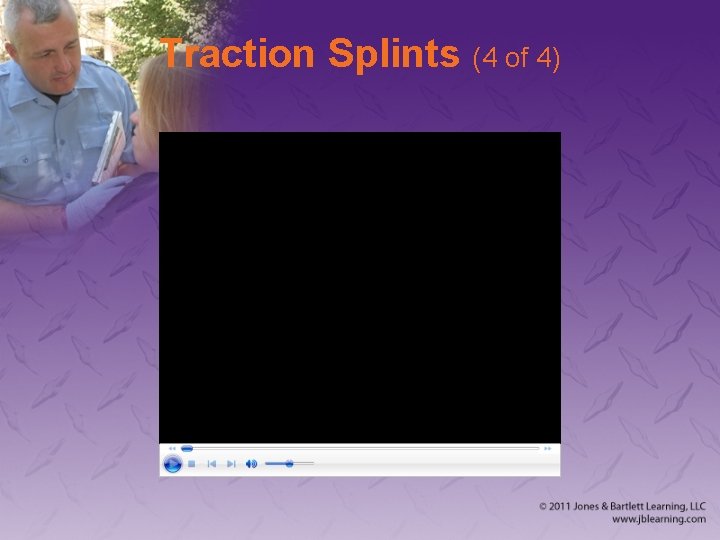 Traction Splints (4 of 4) 