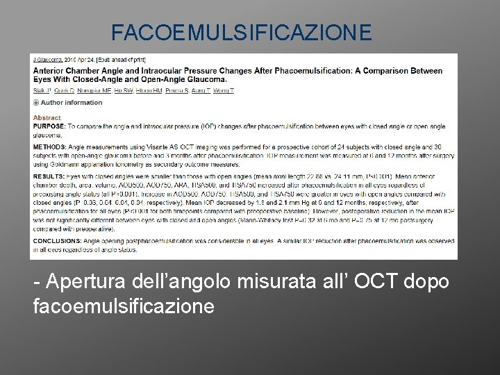 FACOEMULSIFICAZIONE - Apertura dell’angolo misurata all’ OCT dopo facoemulsificazione 