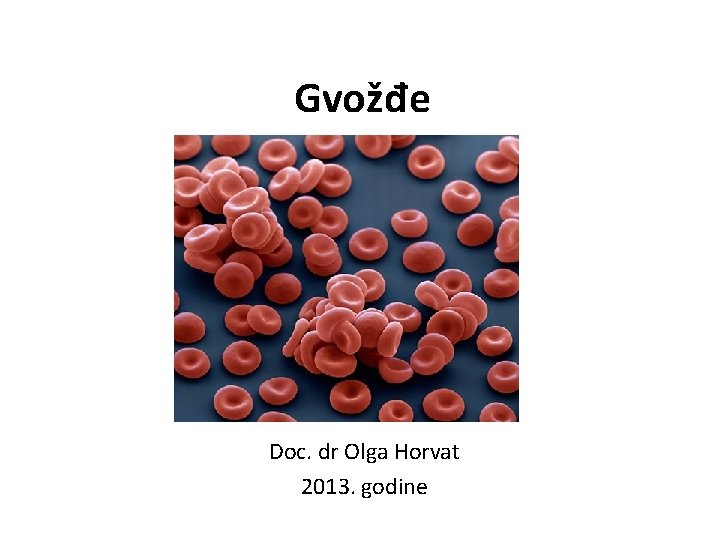 Gvožđe Doc. dr Olga Horvat 2013. godine 