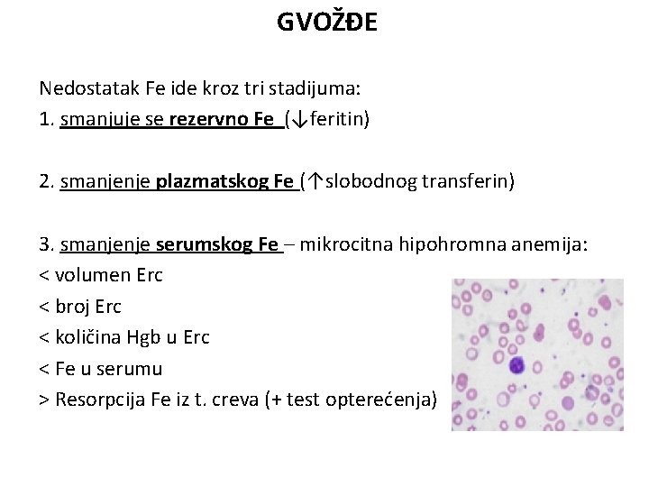 GVOŽĐE Nedostatak Fe ide kroz tri stadijuma: 1. smanjuje se rezervno Fe (↓feritin) 2.