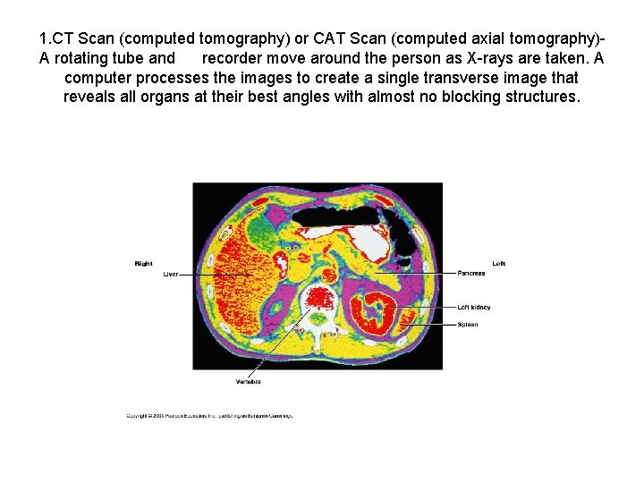 1. CT Scan (computed tomography) or CAT Scan (computed axial tomography)- A rotating tube