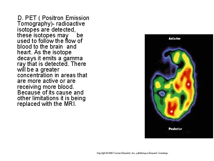  D. PET ( Positron Emission Tomography)- radioactive isotopes are detected, these isotopes may