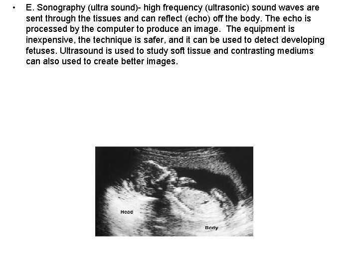  • E. Sonography (ultra sound)- high frequency (ultrasonic) sound waves are sent through