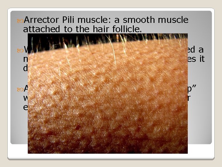  Arrector Pili muscle: a smooth muscle attached to the hair follicle. Why do