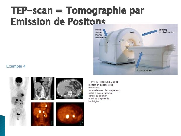 TEP-scan = Tomographie par Emission de Positons 