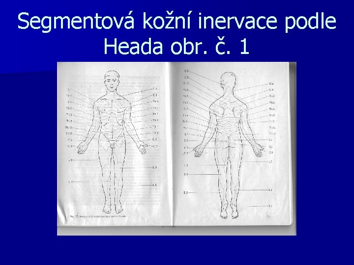 Segmentová kožní inervace podle Heada obr. č. 1 