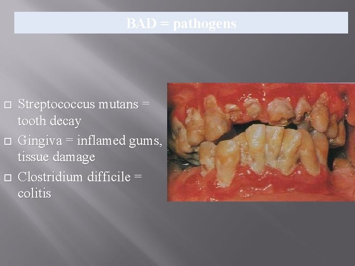 BAD = pathogens Streptococcus mutans = tooth decay Gingiva = inflamed gums, tissue damage BAD = pathogens Streptococcus mutans = tooth decay Gingiva = inflamed gums, tissue damage