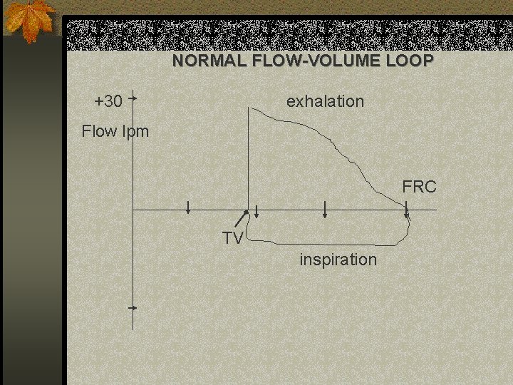 NORMAL FLOW-VOLUME LOOP +30 exhalation Flow lpm FRC TV inspiration 