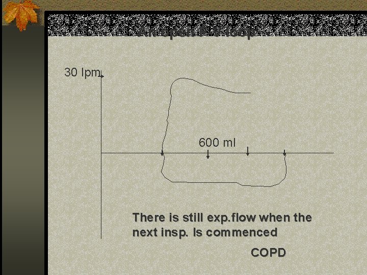 An open F-V loop 30 lpm 600 ml There is still exp. flow when