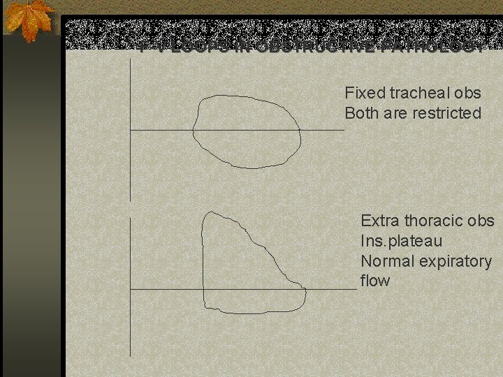 F-V LOOPS IN OBSTRUCTIVE PATHOLOGY Fixed tracheal obs Both are restricted Extra thoracic obs