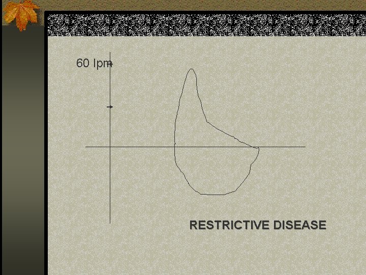 60 lpm RESTRICTIVE DISEASE 