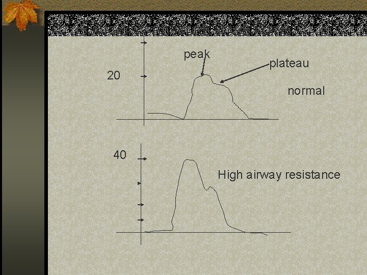 AIRWAY PRESSURE WAVE FORM peak 20 plateau normal 40 High airway resistance 