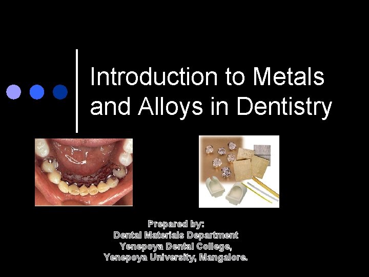 Introduction to Metals and Alloys in Dentistry Prepared by: Dental Materials Department Yenepoya Dental