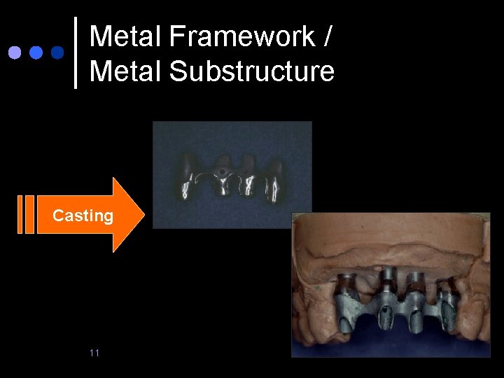 Metal Framework / Metal Substructure Casting 11 
