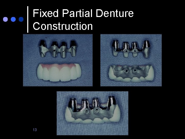 Fixed Partial Denture Construction 13 