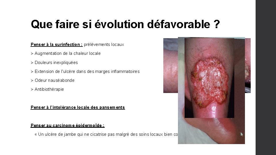 Que faire si évolution défavorable ? Penser à la surinfection : prélèvements locaux Ø