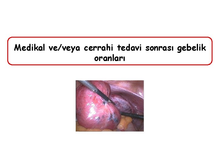 Medikal ve/veya cerrahi tedavi sonrası gebelik oranları 