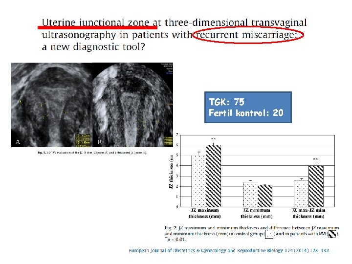 TGK: 75 Fertil kontrol: 20 