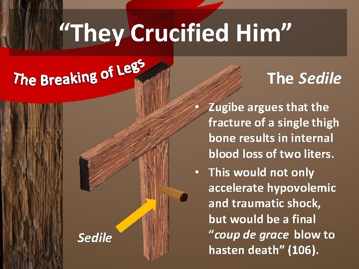 “They Crucified Him” The Sedile • Zugibe argues that the fracture of a single