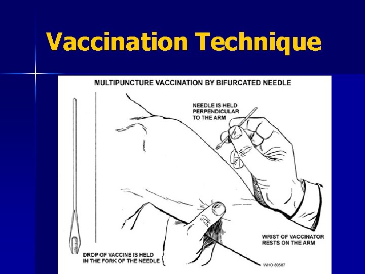 Vaccination Technique 