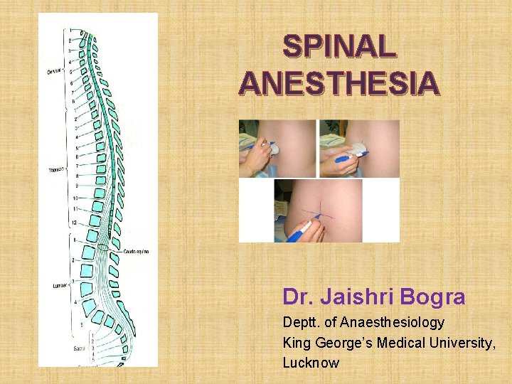  SPINAL ANESTHESIA Dr. Jaishri Bogra Deptt. of Anaesthesiology King George’s Medical University, Lucknow