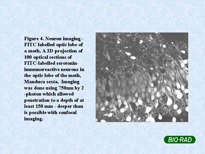 Figure 4. Neuron imaging FITC labelled optic lobe of a moth. A 3 D