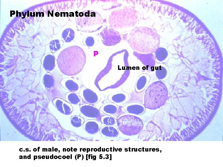 Phylum Nematoda P Lumen of gut c. s. of male, note reproductive structures, and