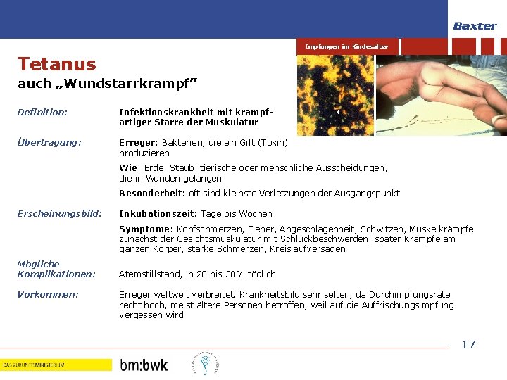 Impfungen im Kindesalter Tetanus auch „Wundstarrkrampf” Definition: Infektionskrankheit mit krampfartiger Starre der Muskulatur Übertragung: