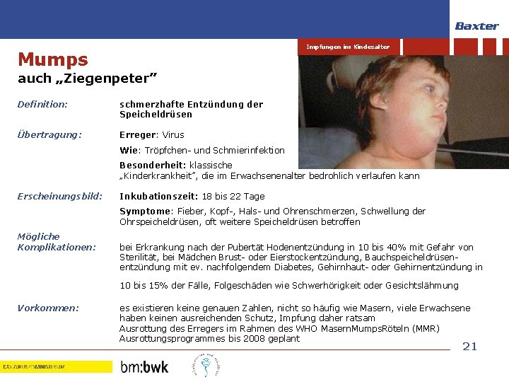 Impfungen im Kindesalter Mumps auch „Ziegenpeter” Definition: schmerzhafte Entzündung der Speicheldrüsen Übertragung: Erreger: Virus