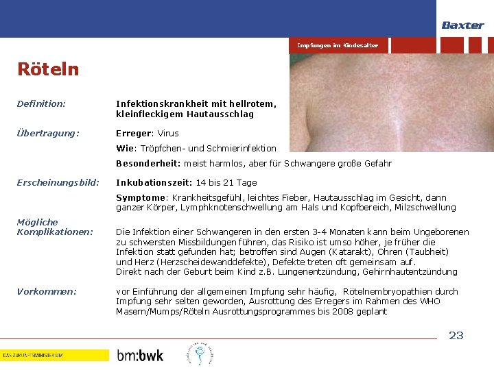 Impfungen im Kindesalter Röteln Definition: Infektionskrankheit mit hellrotem, kleinfleckigem Hautausschlag Übertragung: Erreger: Virus Wie: