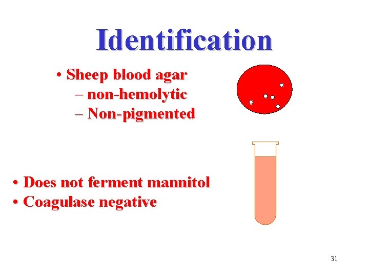 Identification • Sheep blood agar – non-hemolytic – Non-pigmented • Does not ferment mannitol