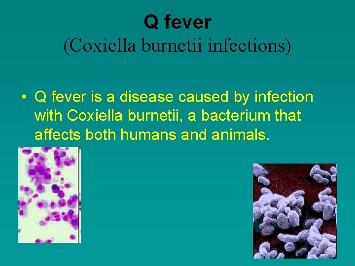 Q fever (Coxiella burnetii infections) • Q fever is a disease caused by infection