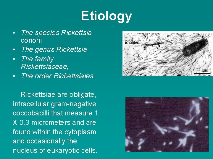 Etiology • The species Rickettsia conorii • The genus Rickettsia • The family Rickettsiaceae,