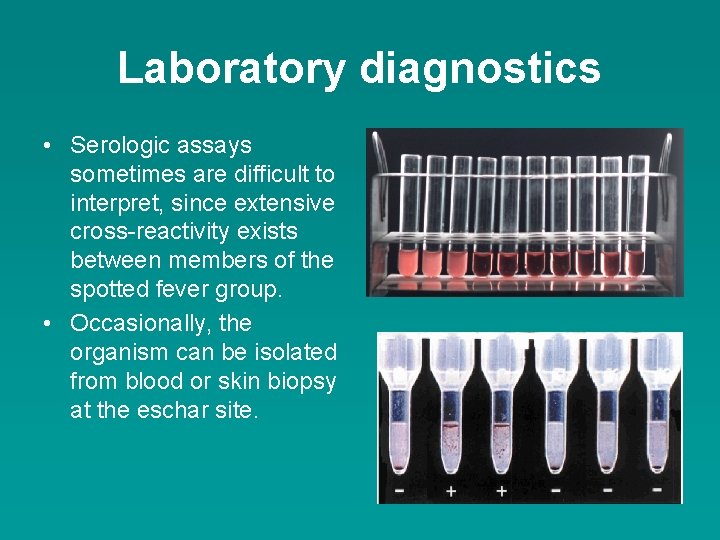 Laboratory diagnostics • Serologic assays sometimes are difficult to interpret, since extensive cross-reactivity exists