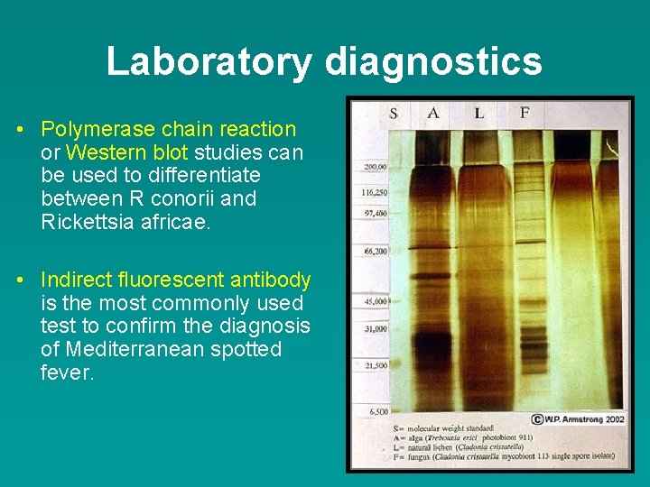 Laboratory diagnostics • Polymerase chain reaction or Western blot studies can be used to