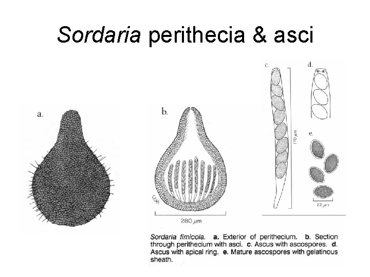 Sordaria perithecia & asci 