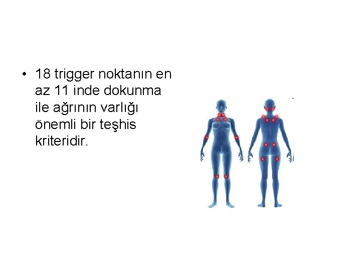  • 18 trigger noktanın en az 11 inde dokunma ile ağrının varlığı önemli