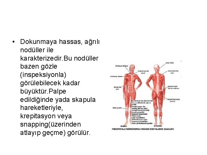  • Dokunmaya hassas, ağrılı nodüller ile karakterizedir. Bu nodüller bazen gözle (inspeksiyonla) görülebilecek