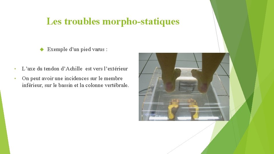 Les troubles morpho-statiques Exemple d’un pied varus : • L’axe du tendon d’Achille est
