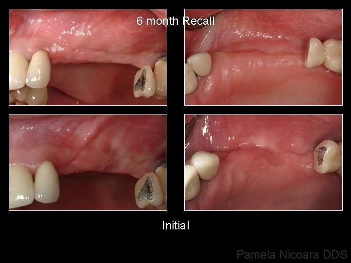 6 month Recall Initial Pamela Nicoara DDS 