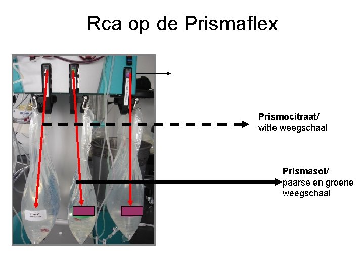 Rca op de Prismaflex Prismocitraat/ witte weegschaal Prismasol/ paarse en groene weegschaal 