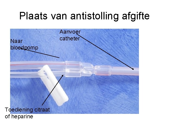 Plaats van antistolling afgifte Naar bloedpomp Toediening citraat of heparine Aanvoer catheter 