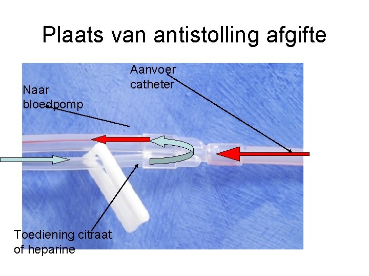 Plaats van antistolling afgifte Naar bloedpomp Toediening citraat of heparine Aanvoer catheter 