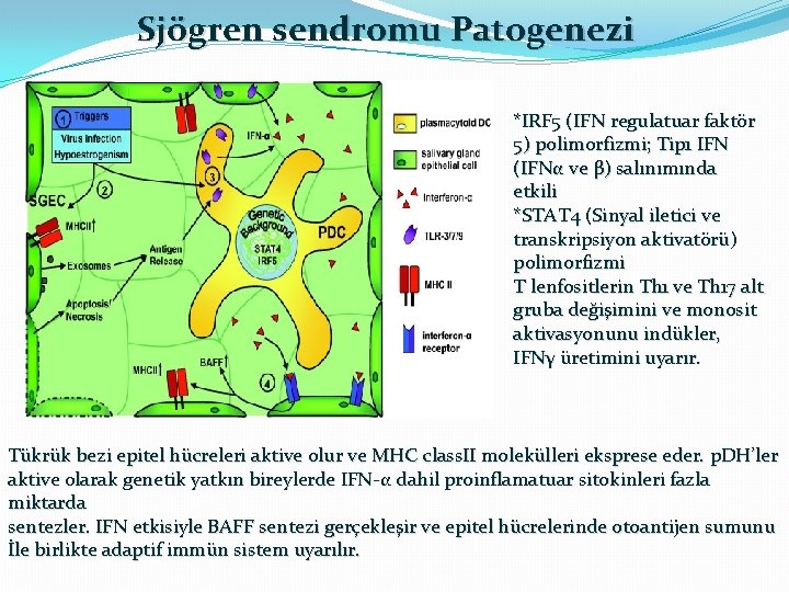 Sjögren sendromu Patogenezi *IRF 5 (IFN regulatuar faktör 5) polimorfizmi; Tip 1 IFN (IFNα
