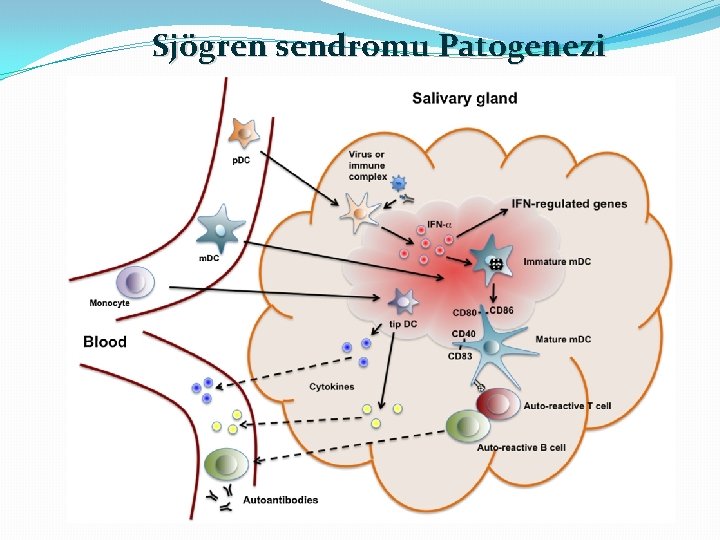 Sjögren sendromu Patogenezi 