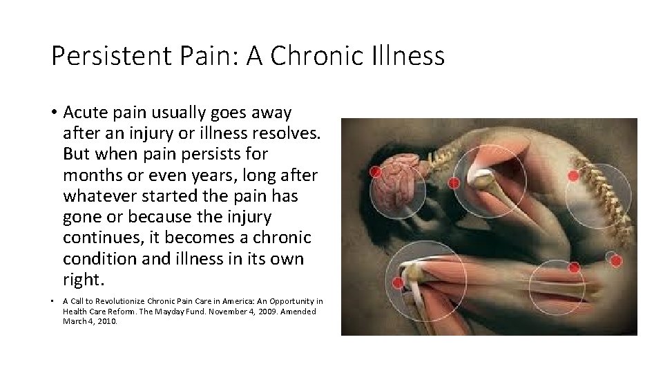Persistent Pain: A Chronic Illness • Acute pain usually goes away after an injury