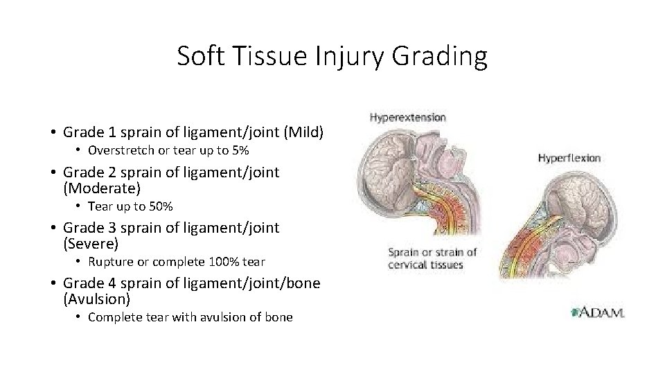 Soft Tissue Injury Grading • Grade 1 sprain of ligament/joint (Mild) • Overstretch or