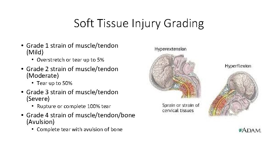 Soft Tissue Injury Grading • Grade 1 strain of muscle/tendon (Mild) • Overstretch or