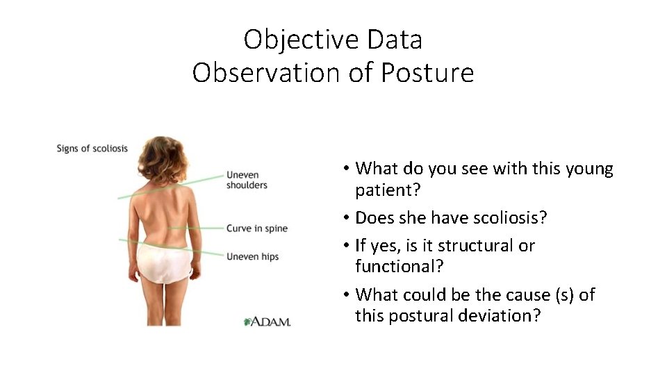 Objective Data Observation of Posture • What do you see with this young patient?